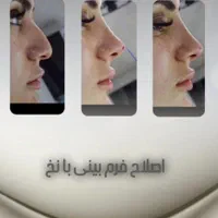 مرکز تخصصی تزریق چربی/فیلرلب و صورت/نخ لیفت/بوتاکس|خدمات آرایشگری و زیبایی|مشهد, سجاد شهر|دیوار