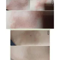 پوستت رو نجات بده احیای کامل با پک گیاهی خاص