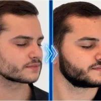 با فیست حال کن