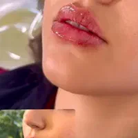 تزریق بوتاکس و ژل در کلینیک(توسط پزشک،)|خدمات آرایشگری و زیبایی|مشهد, هفت تیر (آب و برق)|دیوار