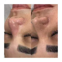 پاکسازی پوست فقط ۳۹۰ هزار تومان