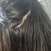 پاکسازی شپش ورشک|خدمات آرایشگری و زیبایی|سبزوار, شرق کال میانی|دیوار