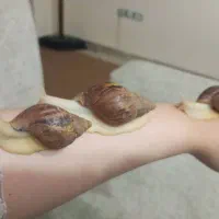 حلزون کلاژن ساز