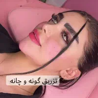 تزریق ژل و بوتاکس پک مادلینگ، مزونیدلینگ ۵۰٪تخفیف|خدمات آرایشگری و زیبایی|پردیس, فاز ۱|دیوار