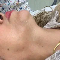 لیزر موهای زائد سفید و سیاه فقط در یک جلسه