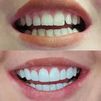 کامپوزیت زیبایی|خدمات آرایشگری و زیبایی|اسلام‌شهر, شهرک قائمیه|دیوار