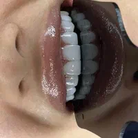 دندانپزشکی / قیمت دولتی