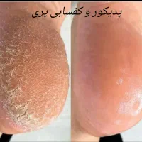 اولین کلینیک تخصصی پدیکور پا|خدمات آرایشگری و زیبایی|کرمانشاه, |دیوار