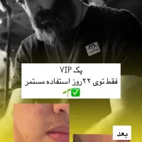رشد ریش تضمینی|آرایشی، بهداشتی، درمانی|تهران, آبشار|دیوار