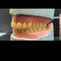 بهدارتجربی دندان و دندانساز|خدمات آرایشگری و زیبایی|بروجرد, |دیوار