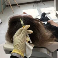 تخفیفات فوق العاده در کلینیک پوست ومو|خدمات آرایشگری و زیبایی|اندیشه, اندیشه فاز ۶|دیوار