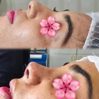 عمل بینی و تمام عمل های زیبایی