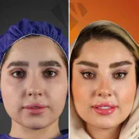 جشنواره تکرار نشدنی ساکشن غبغب و ..کلینیک پالادیوم|خدمات آرایشگری و زیبایی|شیراز, معالیآباد|دیوار