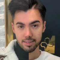 خدمات تخصصی تزریق بوتاکس فیلر بانوان و آقایون|خدمات آرایشگری و زیبایی|بیرجند, |دیوار