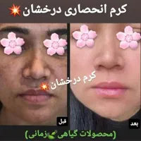 (کرم ضدلک و روشن کننده درخشان)بدون بازگشت|آرایشی، بهداشتی، درمانی|شیراز, قصرالدشت|دیوار