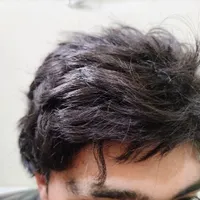 کلاه گیس