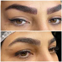 جشنواره میکرو و شیدینگ لب و پاکسازی رایگان