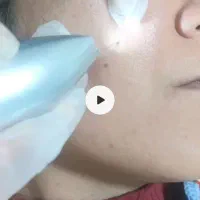 پیرسینگ 350‌‌ هزار .. خالبرداری300