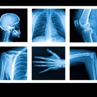 عکس سی تی اسکن و رادیولوژی