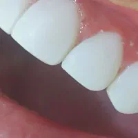 dental