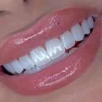 جشنواره تخفیف دندانپزشکی رها کامپوزیت و لمینیت و..