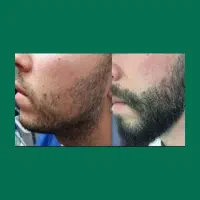 موهات حرف اول