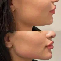 خدمات زیبایی امیدیه|خدمات آرایشگری و زیبایی|امیدیه, |دیوار