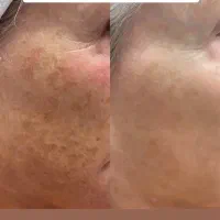 صابون روشن کننده|آرایشی، بهداشتی، درمانی|برازجان, |دیوار