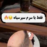 رویش پرپشتی ضخامت