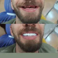 خدمات دندانپزشکی و دندانسازی با ضمانت ، اقساط