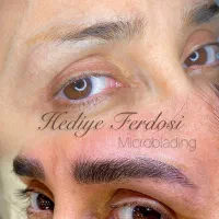 میکروبلیدینگ طبیعی و تخصصی،تخیفیف ویژه ی نوروز