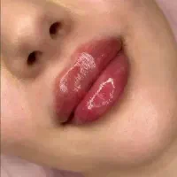 خدمات ژل و بوتاکس و پیرسینگ و چال گونه،خالبرداری