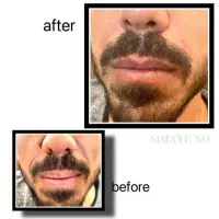 تزریق ژل و بوتاکس، نخ، مزو، فیلربادی|خدمات آرایشگری و زیبایی|ری, اقدسیه|دیوار