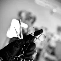 پیرسینگ،میکرودرمال،چالگونه