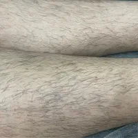 اپیلاسیون تخصصی بانوان