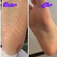 مدل پدیکور و کفسابی خیس|خدمات آرایشگری و زیبایی|اصفهان, کوی امیریه|دیوار