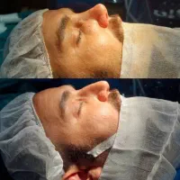 تسهیلات آسان جراحی تا ۲۰۰ میلیون