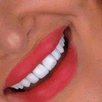کامپوزیت و لمینت تخصصی/اقساط بدون سود /توسط پزشک