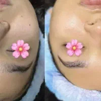 پاکسازی پوست ۲۵۰ تومن مدت محدود