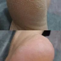 پدیکور درمانی|خدمات آرایشگری و زیبایی|اسدآباد, |دیوار