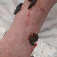 حجامت،زالو‌درمانی، فصدخون،طب سوزنی،مزاج شناسی|خدمات آرایشگری و زیبایی|تهران, بیسیم|دیوار