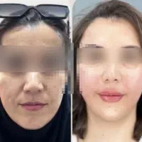 خدمات تخصصی پوست و مو در کلینیک فرسیما