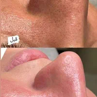 پاکسازی پوست بانوان