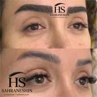 کاشت ابروی طبیعی|خدمات آرایشگری و زیبایی|تهران, قیطریه|دیوار