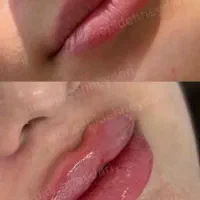 مرکز زیبایی و لیزر در فاز ۲ سهند|خدمات آرایشگری و زیبایی|سهند, |دیوار