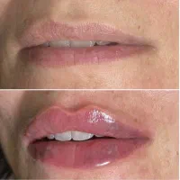 خدمات زیبایی توسط پزشک
