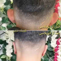 عمل جراحی پلک(بلفاروپلاسی)جراحی گوش(اتوپلاسی)|خدمات زیبایی و سلامت|تهران, آبشار تهران (دریاچه)|دیوار