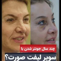 خدمات زیبایی و جوانسازی|خدمات آرایشگری و زیبایی|کرمانشاه, |دیوار
