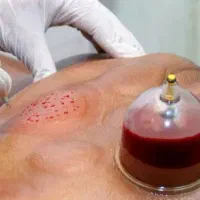 طب سنتی زیر نظر پزشک