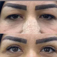 جشنوراه جراحی پلک بالا بلفاروپلاستی|خدمات آرایشگری و زیبایی|اصفهان, خانه اصفهان|دیوار